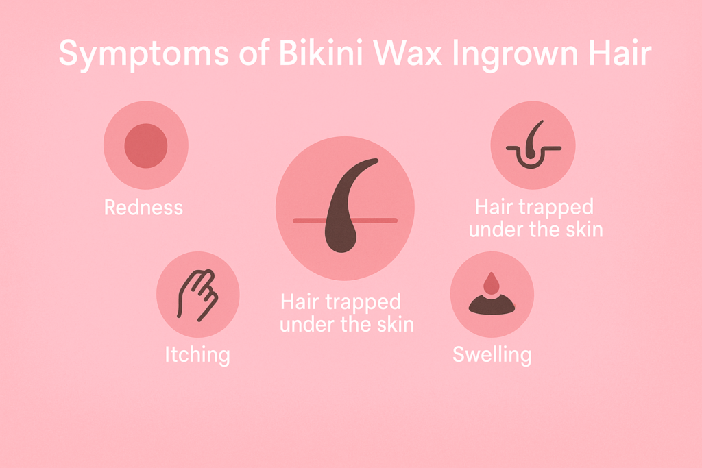 What Are The Symptoms of Bikini Wax Ingrown Hair